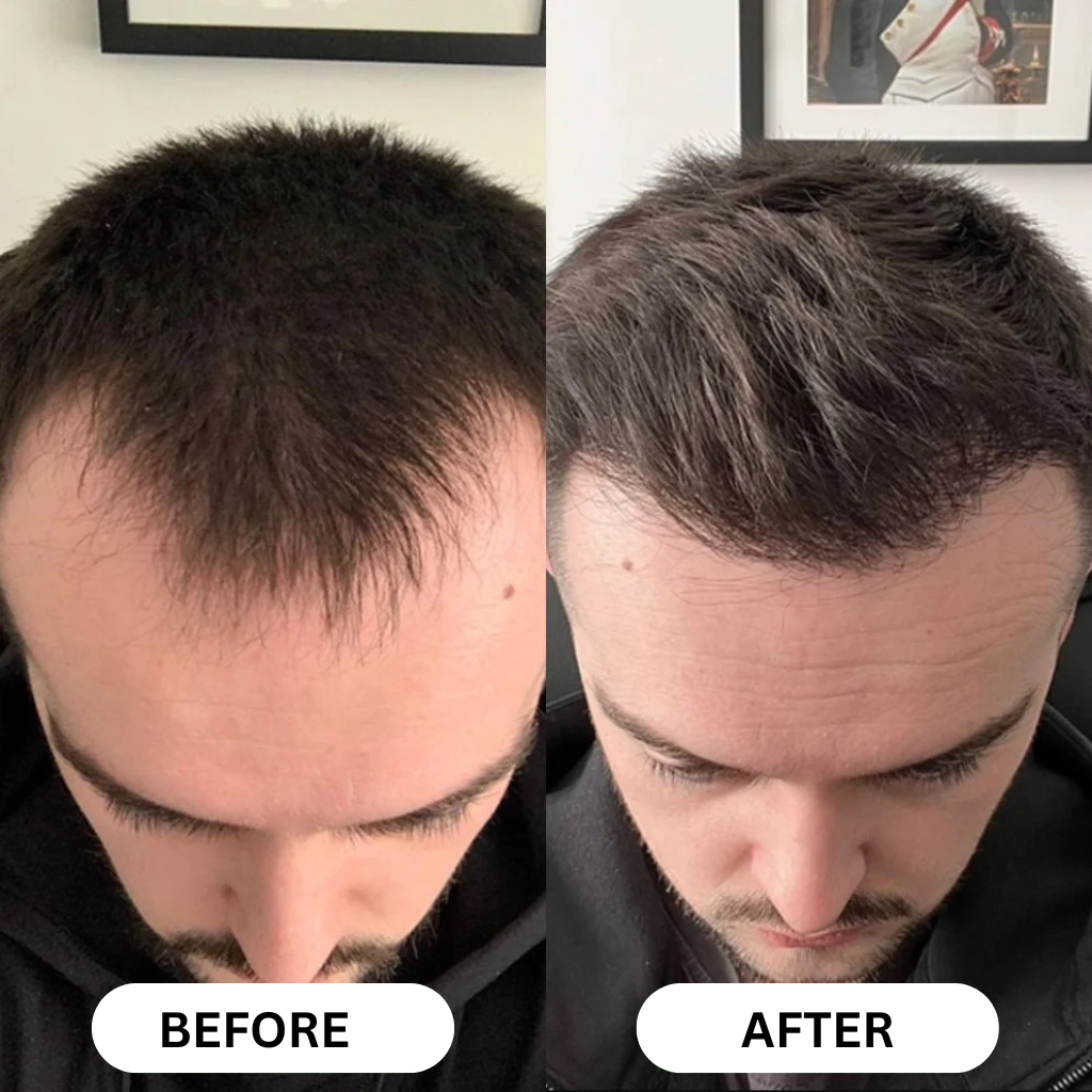 Regrowth - Hair Growth Serum