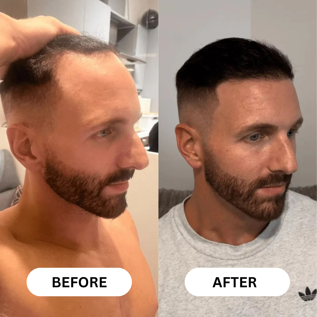 Regrowth - Hair Growth Serum